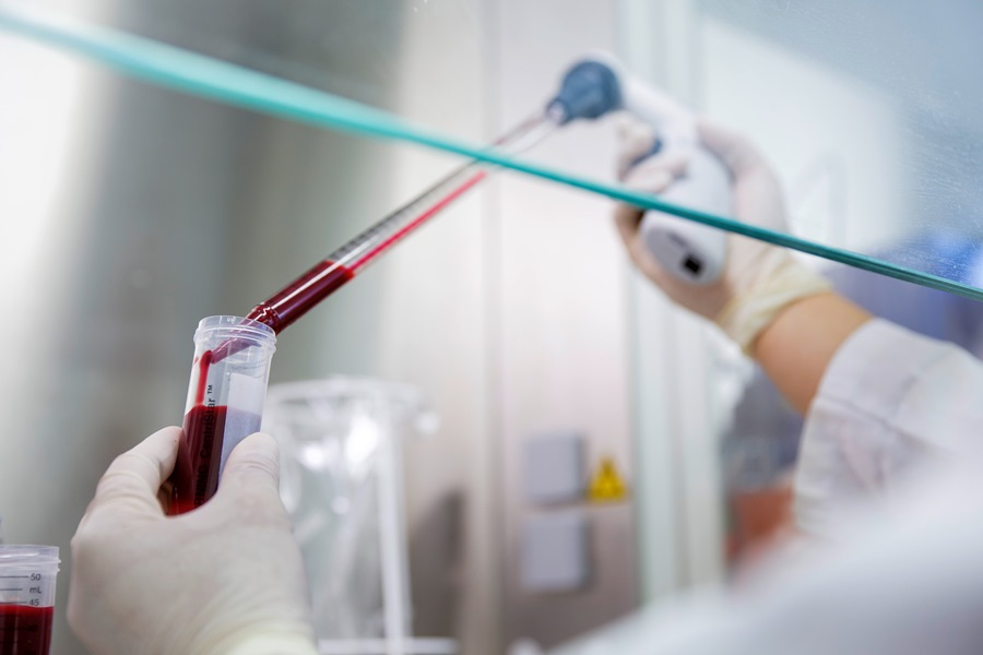 Untersuchung von Blut in einer Pipette