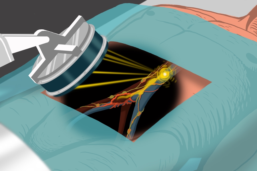 Digitales Bild: fokussierter Ultraschall