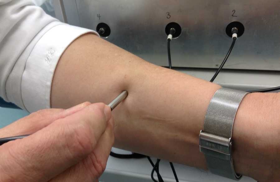 Nahufnahme des UV-LED-Stifts auf der Haut